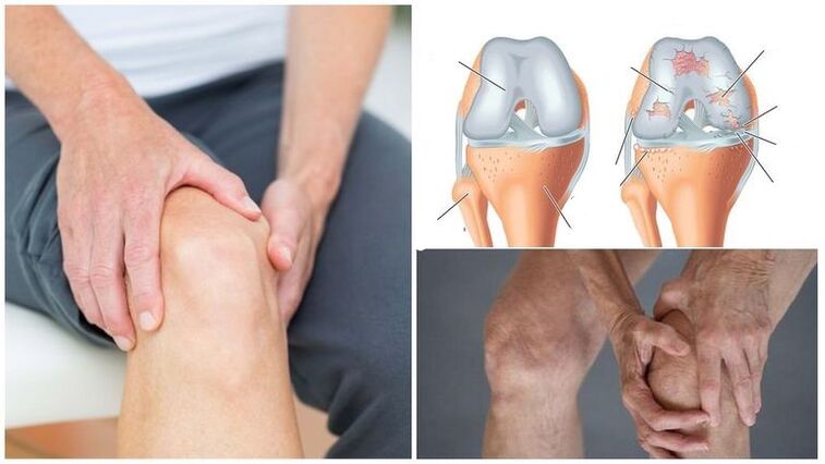 أعراض آلام الركبة من المفاصل